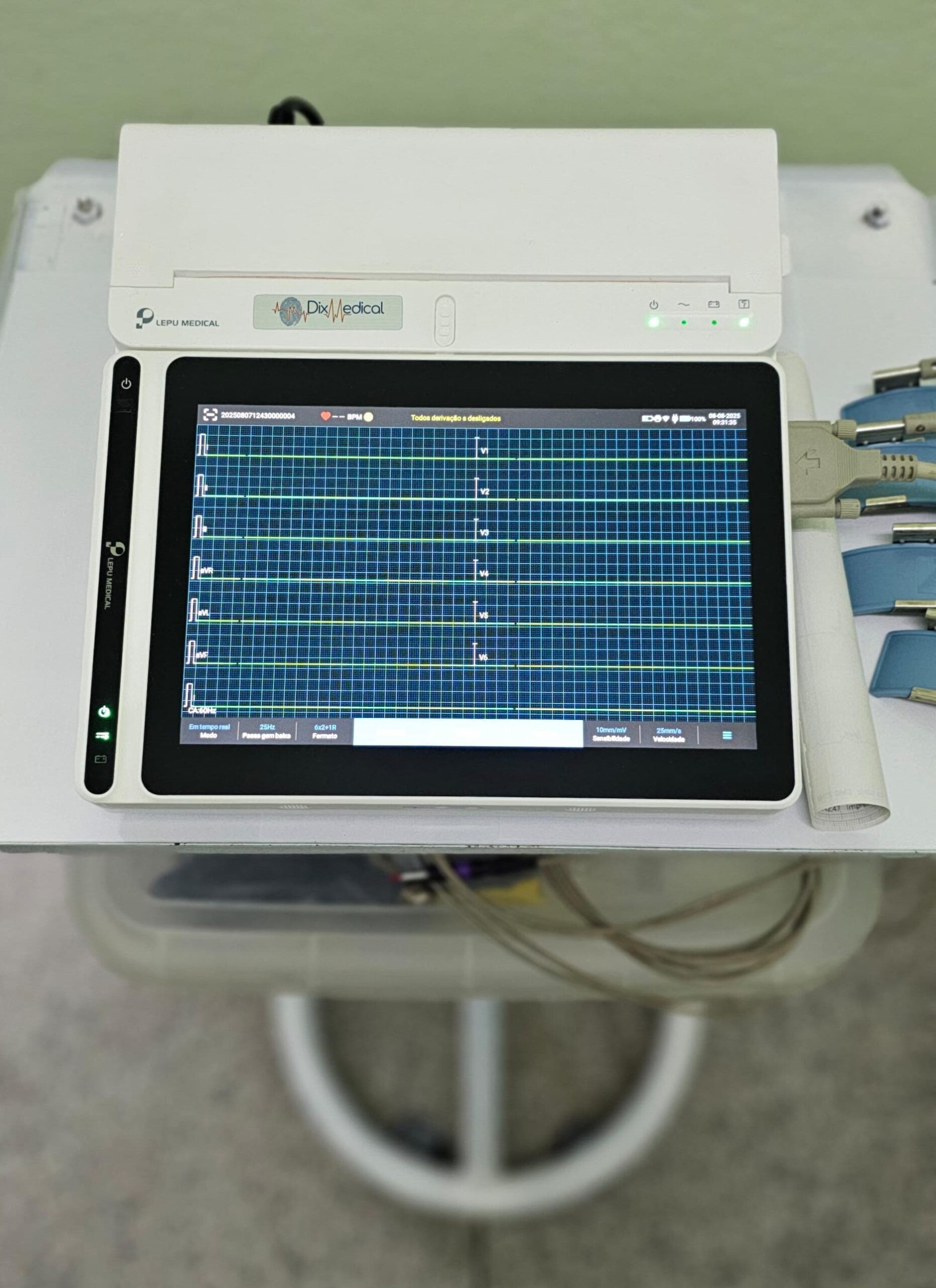 eletrocardiograma